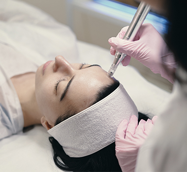 Exceed Microneedling