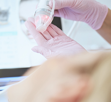 InMode Fractora Microneedling with Radiofrequency