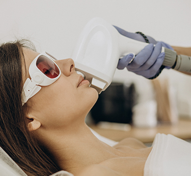 IPL Photofacial