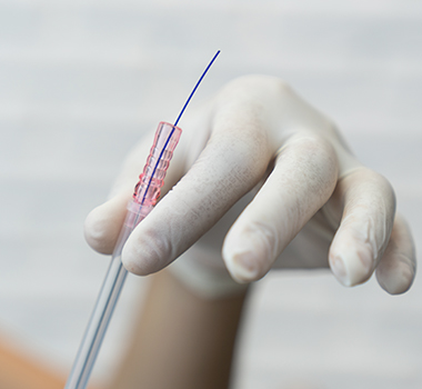 Non-surgical Thread lift